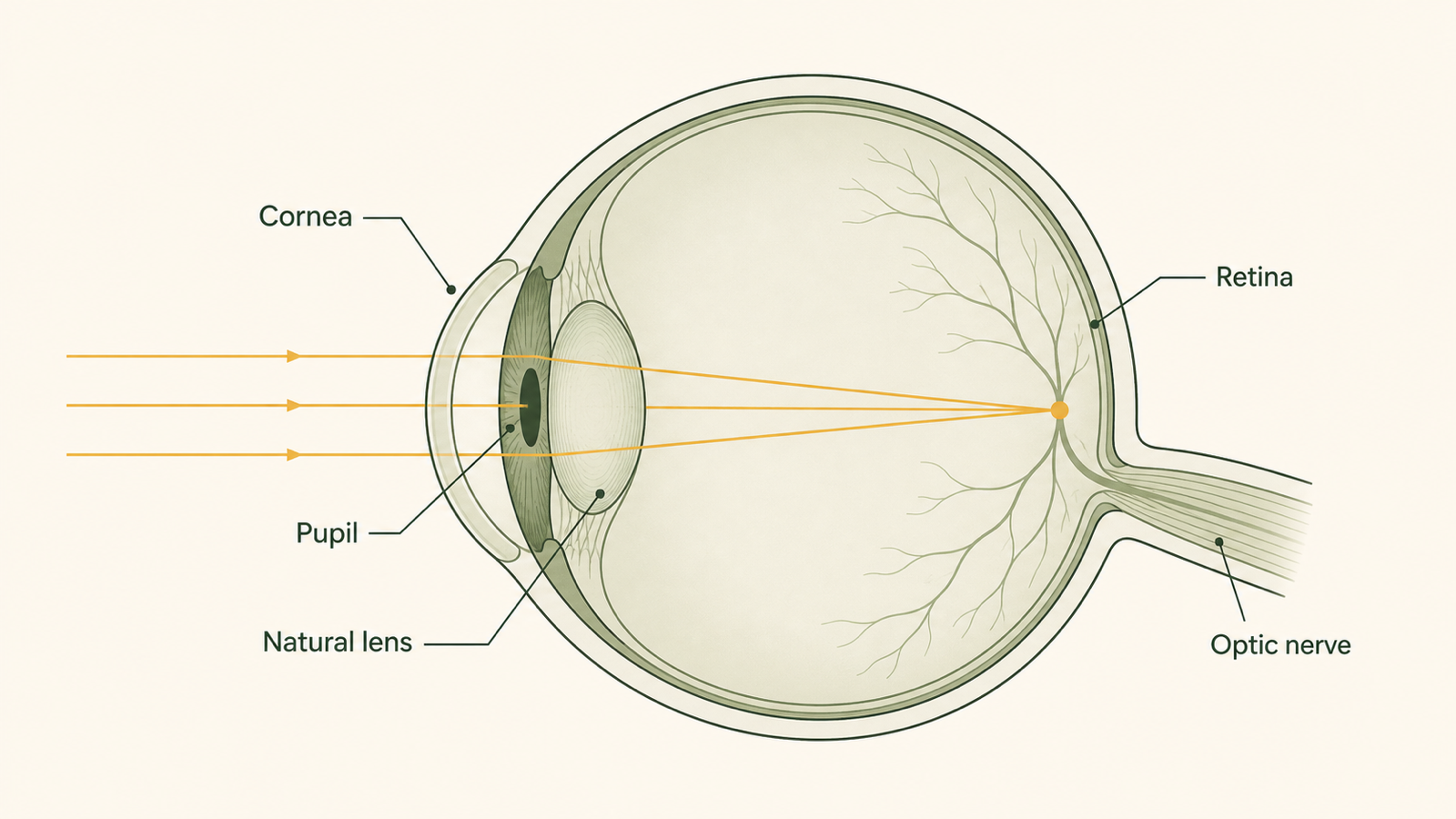 Simplified cross-section of the eye showing light passing through the cornea, pupil and natural lens to focus on the retina.